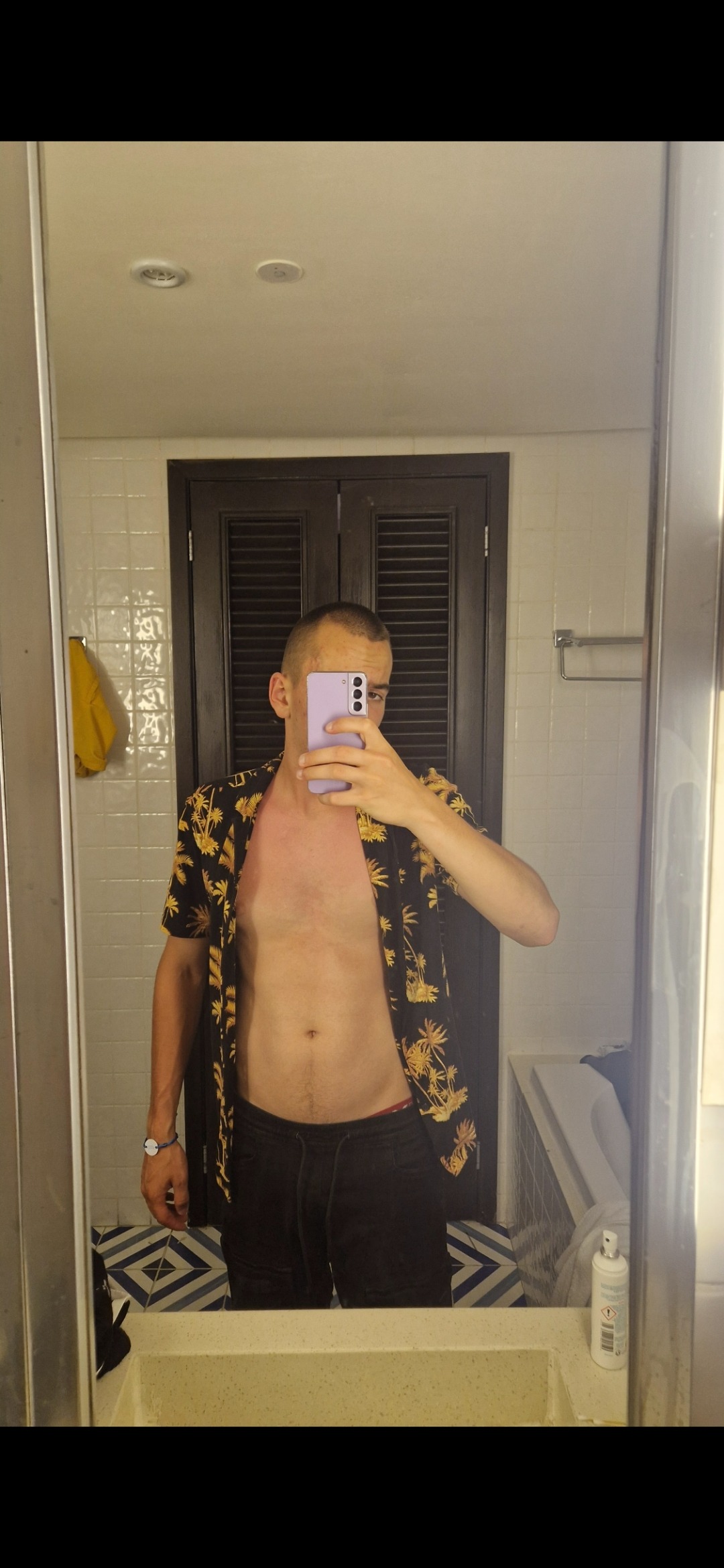 Profil de Lorris, 20 ans, Escorte à Oberwampach